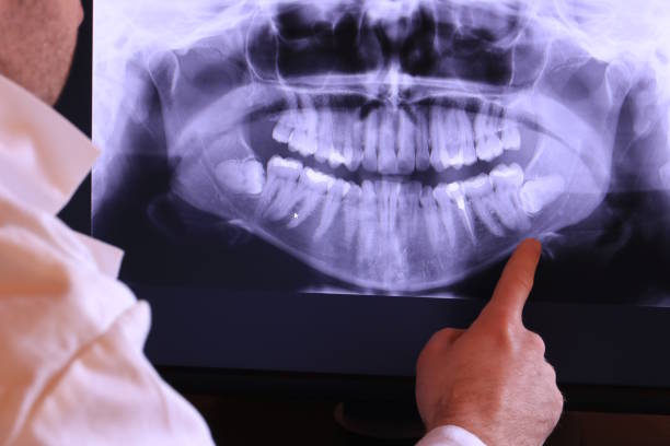 Best Knocked-Out Tooth Emergency  in Hilton, NY